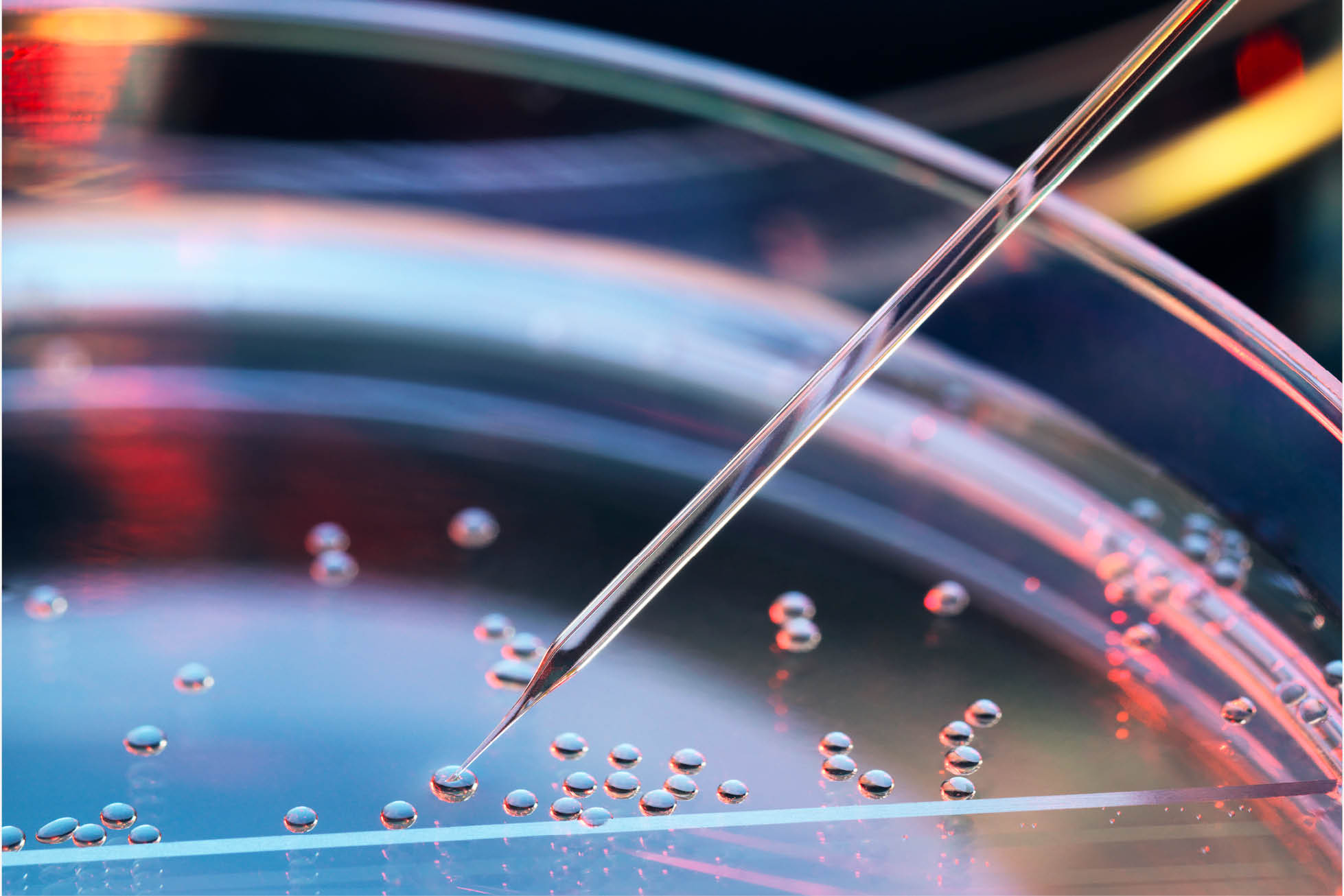 petri dish